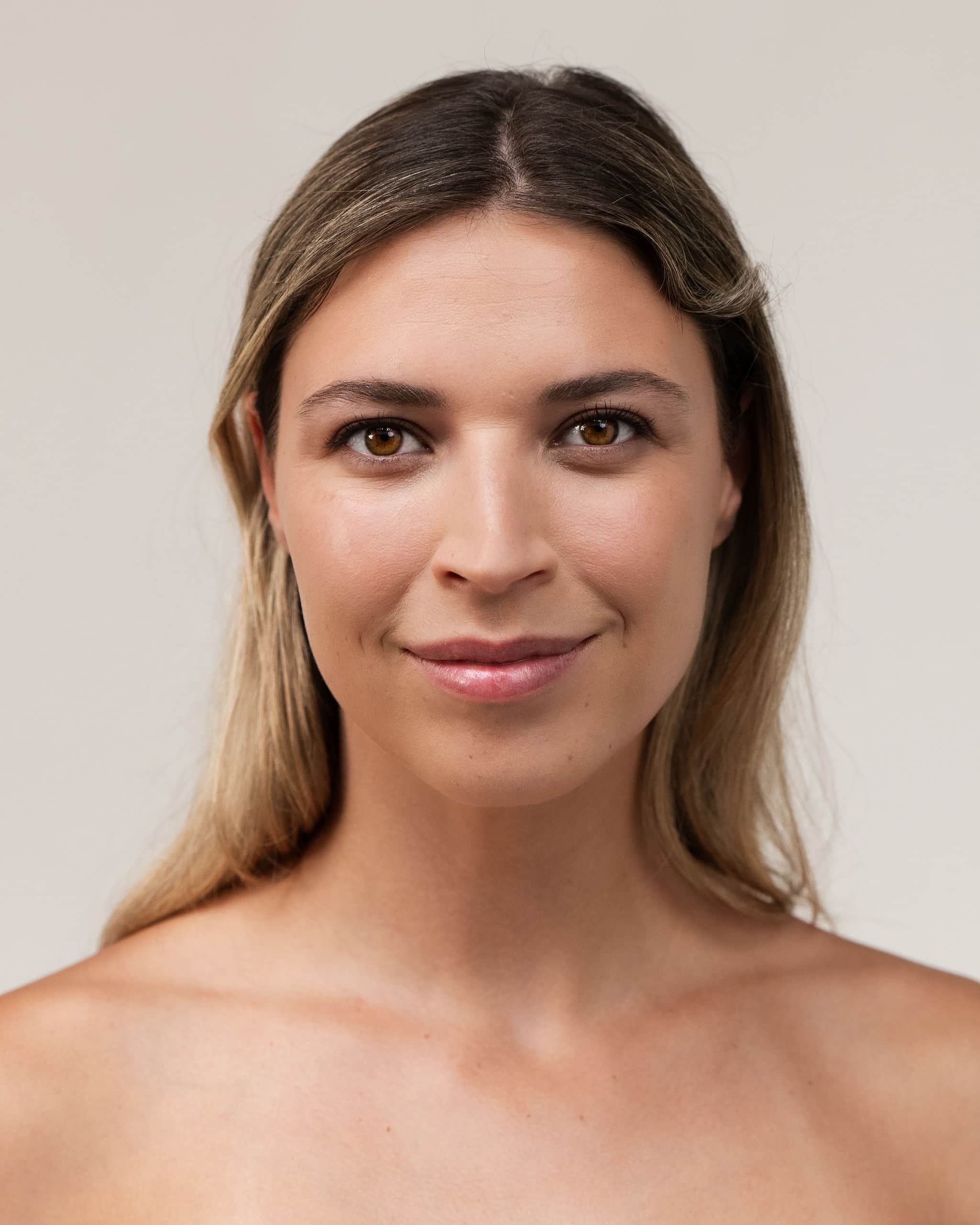 Botox SkinSurgeryClinics 1